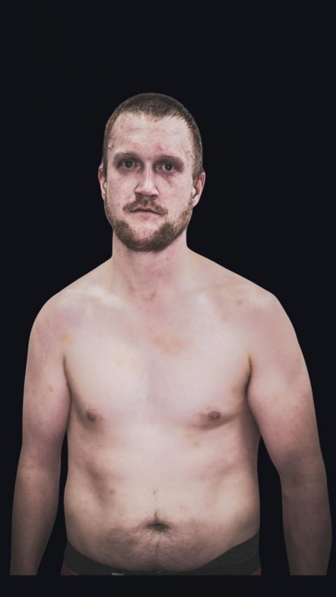 Kolton Renz